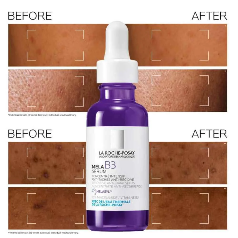 La Roche Posay Correct & Protect Bundle - Mela B3 Serum + Anthelios Age Correct SPF50 - Image 2