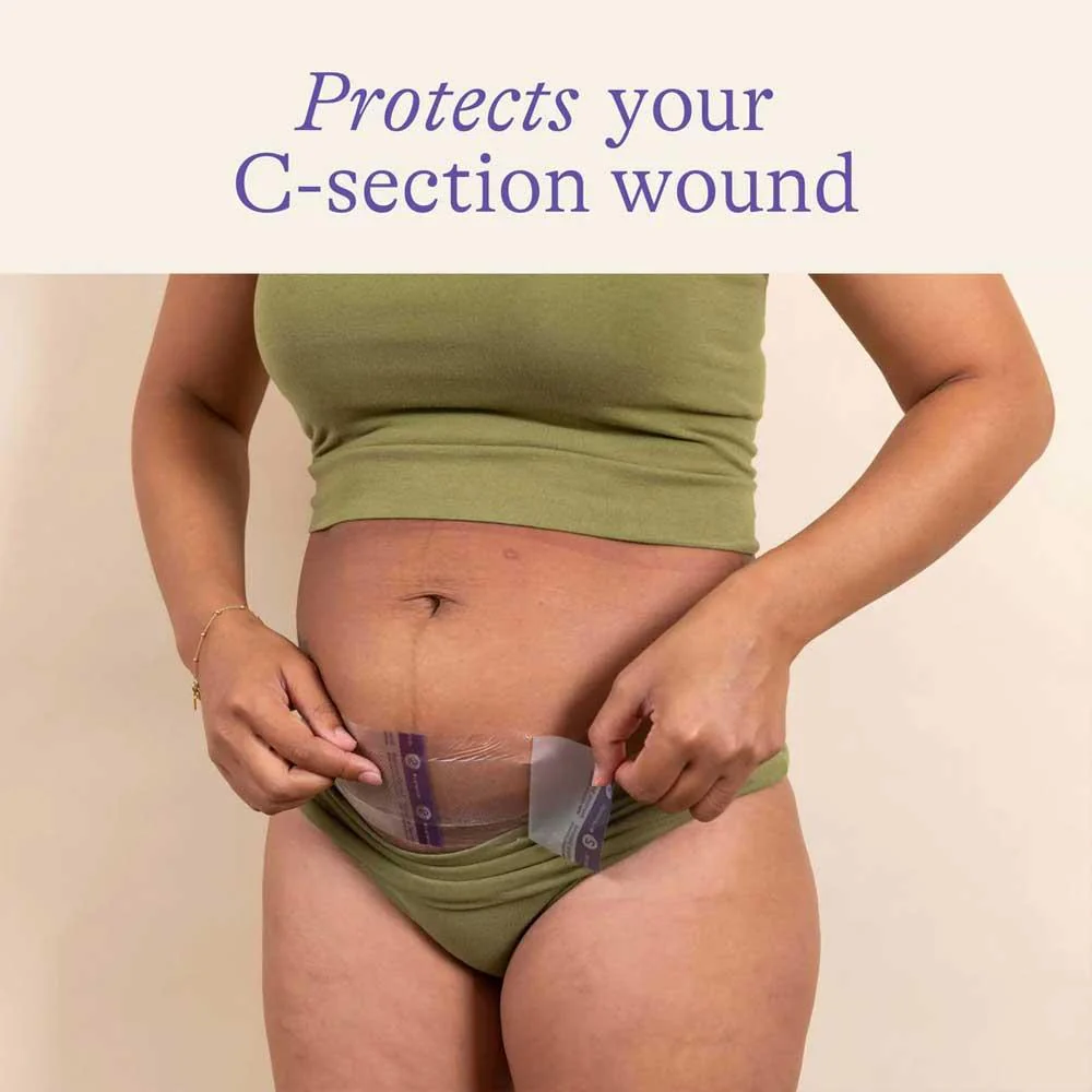 Lansinoh C-Section Hydrogel Pads 2 Pack - Image 6