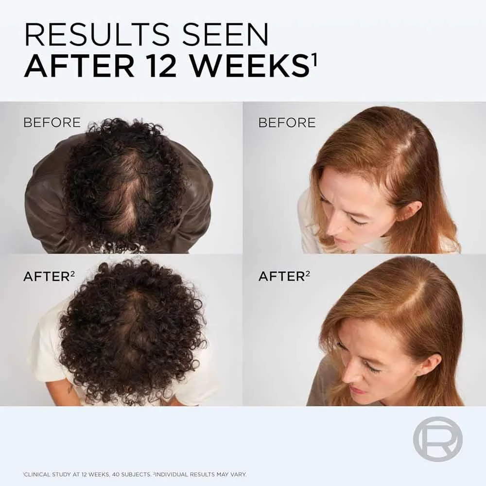L'Oreal Elvive Hair Growth Booster Conditioner - Image 5