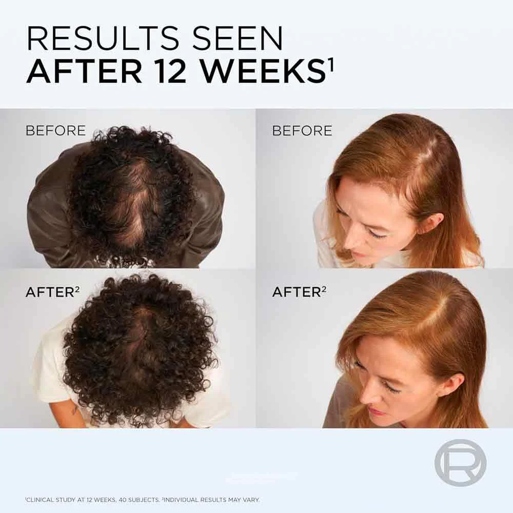 L'Oreal Elvive Hair Growth Booster Serum - Image 5