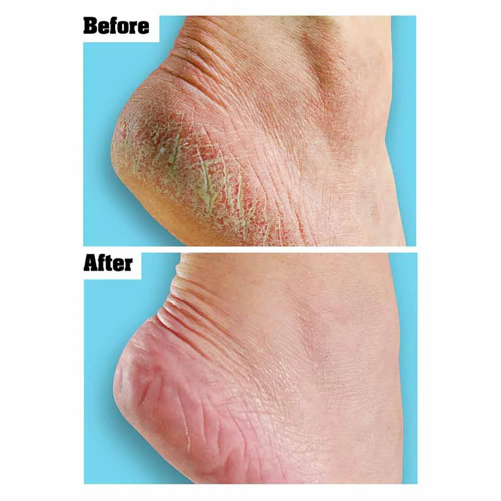 O'Keeffe's For Healthy Feet Foot Cream 91g - Image 3
