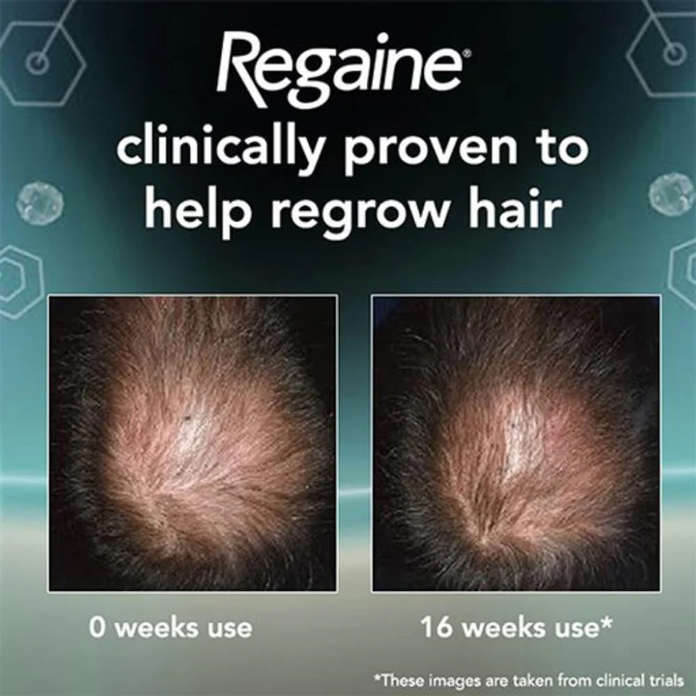 Regaine For Men Extra Strength Foam 5% Minoxidil 3 Month Supply 3x60g - Image 6