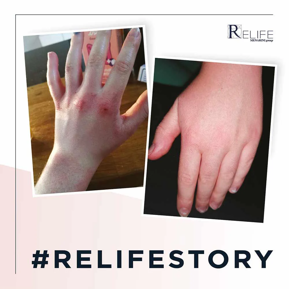 Relife Relizema Cream 100ml - Image 4
