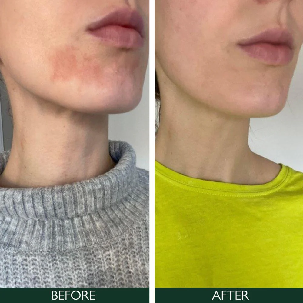 Sorted Skin 5 In 1 Anti-Redness Day Cream SPF50 30ml - Image 3